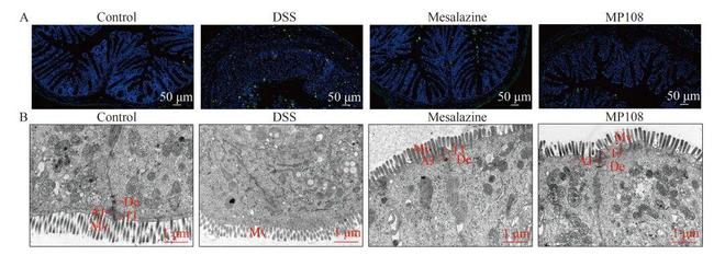 FSHW鼠李糖乳杆菌MP108通过增强肠道屏障、抑制炎症和调节肠道菌物群减轻小鼠溃疡性结肠炎(图5)